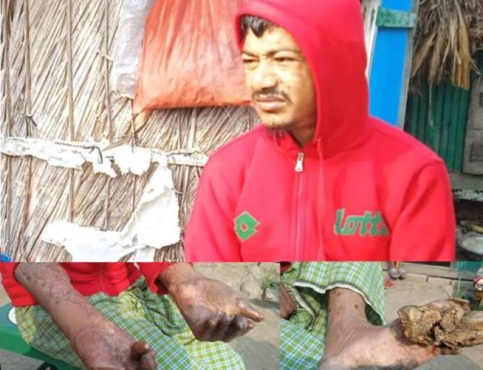 Bangladeschische Baummänner und -frauen vor vielfältigen Herausforderungen