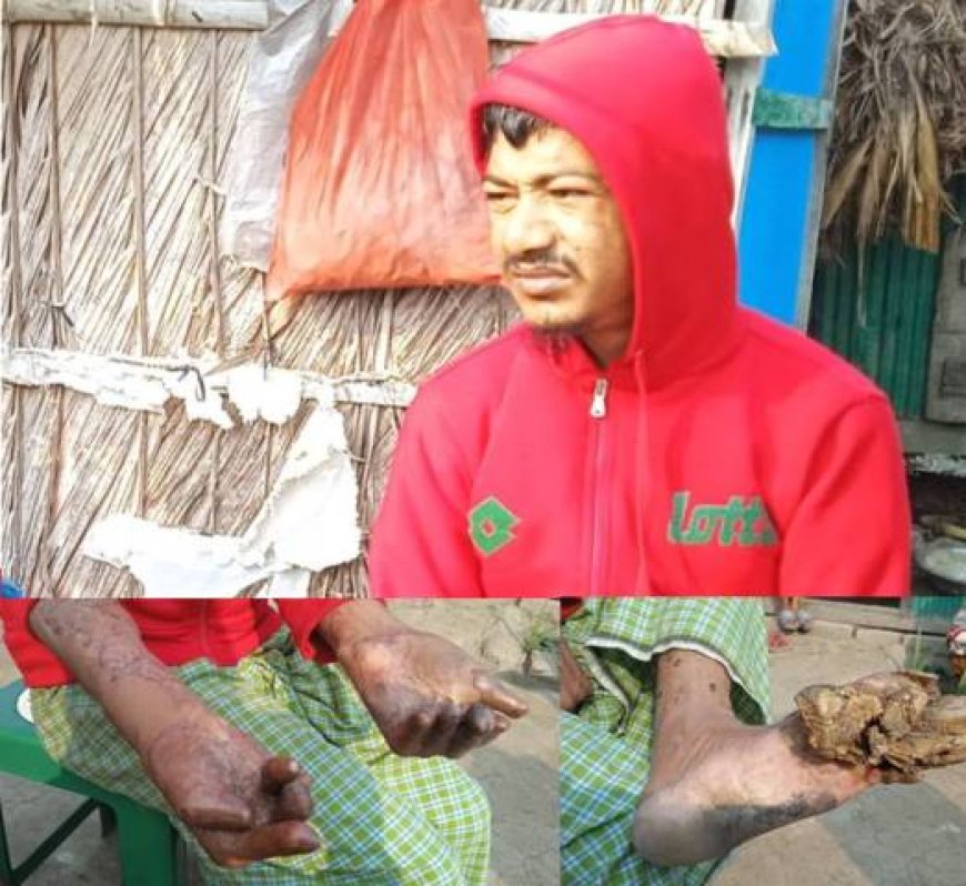 Bangladeschische Baummänner und -frauen vor vielfältigen Herausforderungen 